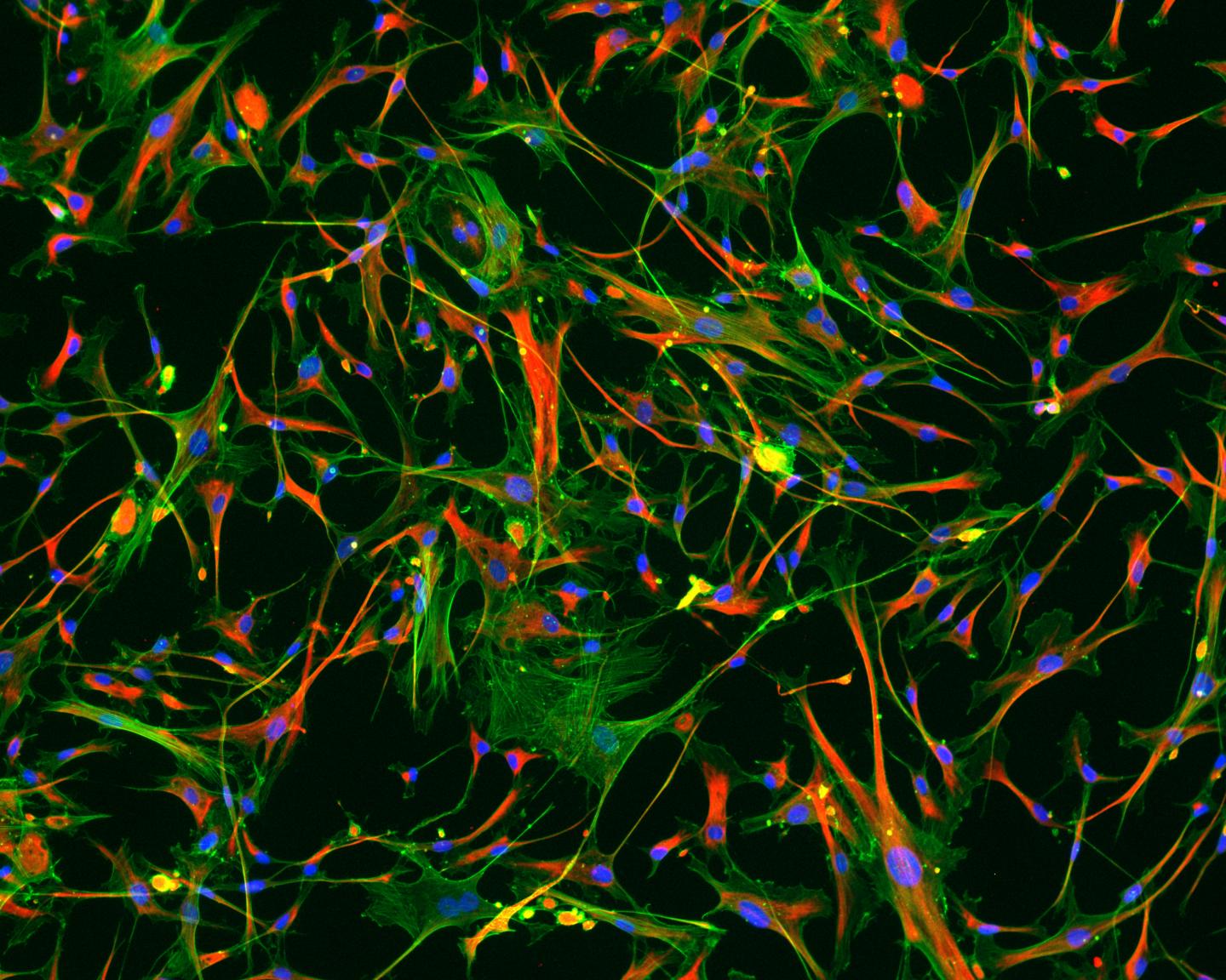 Failing Heart Cells