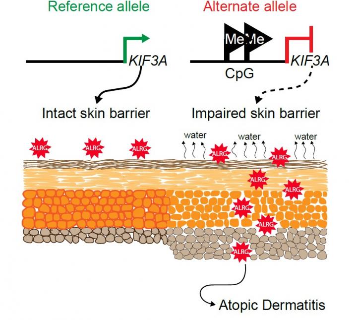 How Atopic Dermatitis Increases Allergy Risk