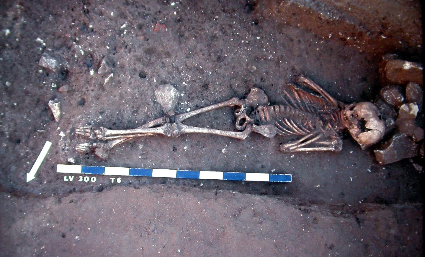 Victim of the Plague