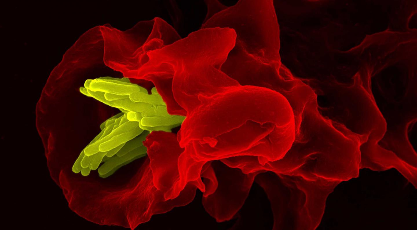 Why Are We Still Fighting Tuberculosis? (Video)