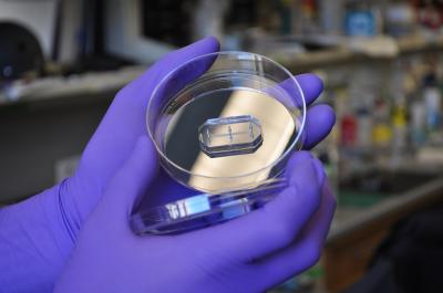 Organs-on-Chips