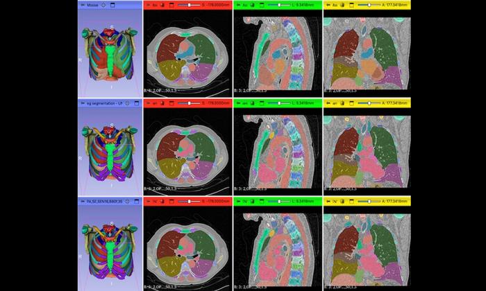 Example of segmentation visualization in the CrossSegmentationExplorer system