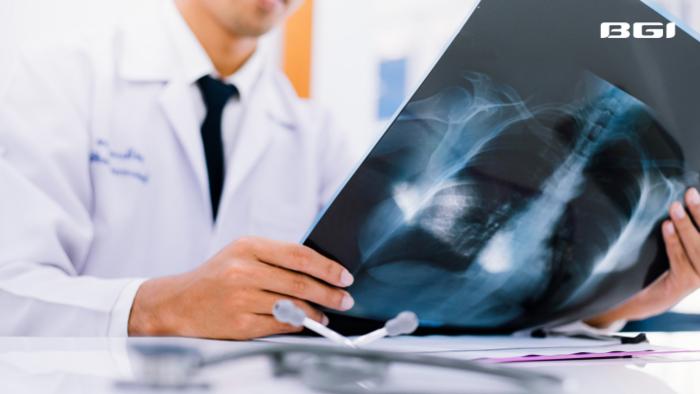 Non-Smokers Account for 20% of Lung Cancer Diagnoses |BGI Insight