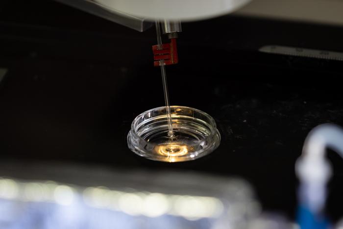 Poking neuronal membrane