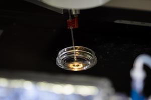 Poking neuronal membrane