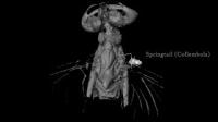 Video of CT Scan