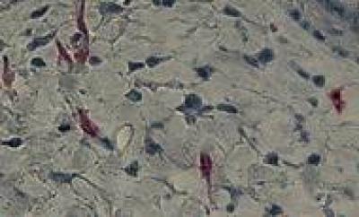 Nerve Fibers
