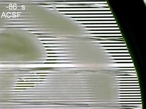 Transmission images of an acute brain slice cleared with SeeDB-Live