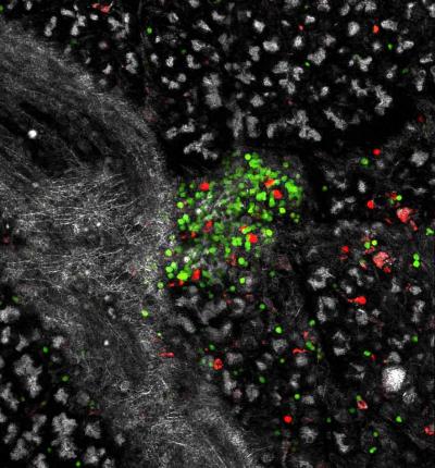 Mouse Pancreas