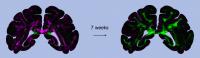 Diattenuation Imaging  (DI) Reveals Regional Differences