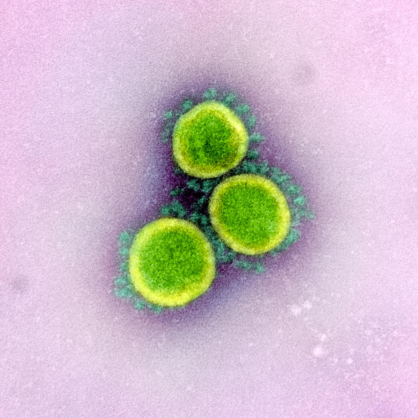 SARS-CoV-2 virus particles