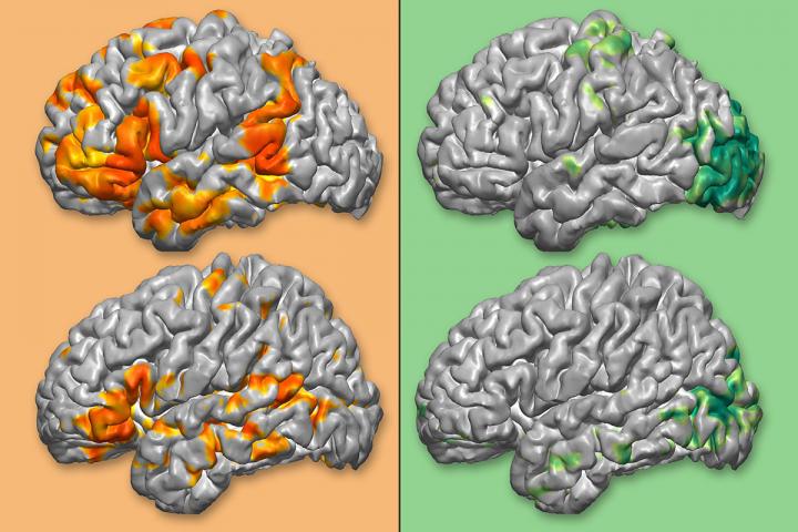 Maps of Brain Functions