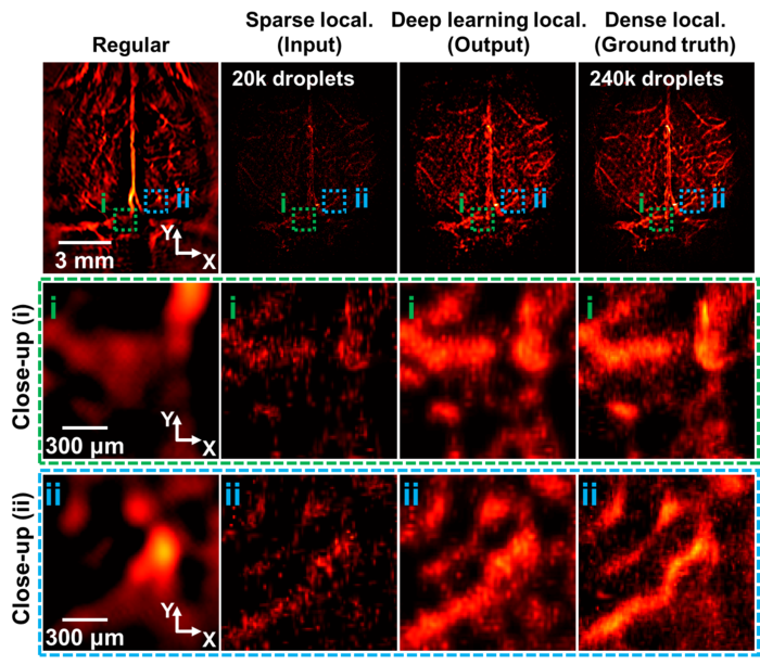 Deep Learning-Based 2D Labeled Localization Photoacoustic Computed Tomography.
