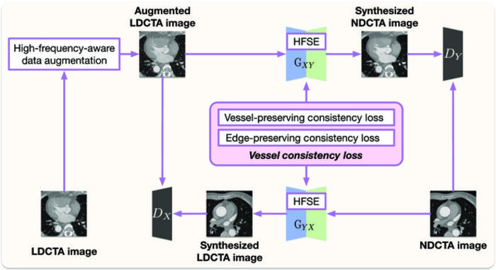 The framework of the proposed denoising method.