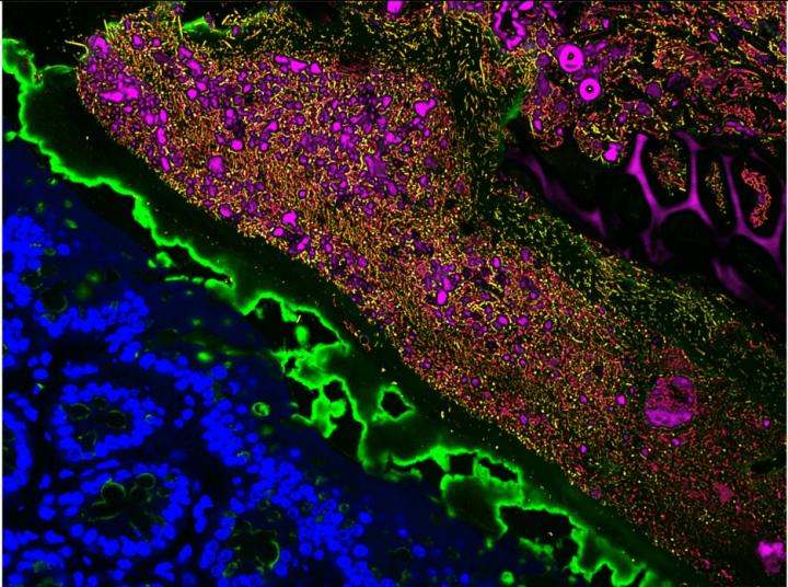Microbiome species diversity