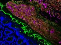 Microbiome species diversity