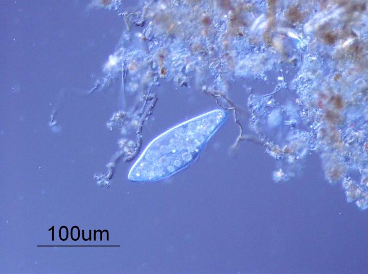<i>Paramecium</i>