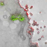 Golgi and Plasma Membrane Tissue