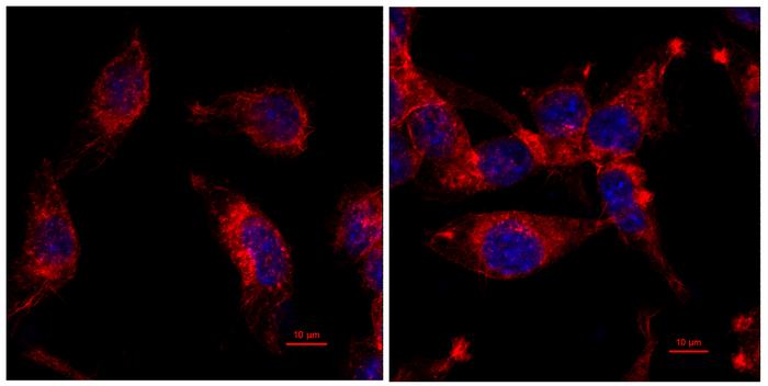 Gene mutation helps some cancer tumors grow rapidly while avoiding immune checkpoint inhibitors