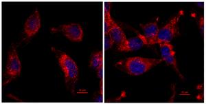 Gene mutation helps some cancer tumors grow rapidly while avoiding immune checkpoint inhibitors
