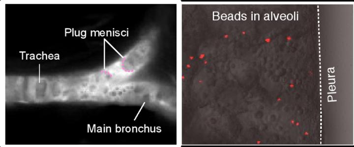 Columbia Engineering Team Develops Targeted Drug Delivery to Lung