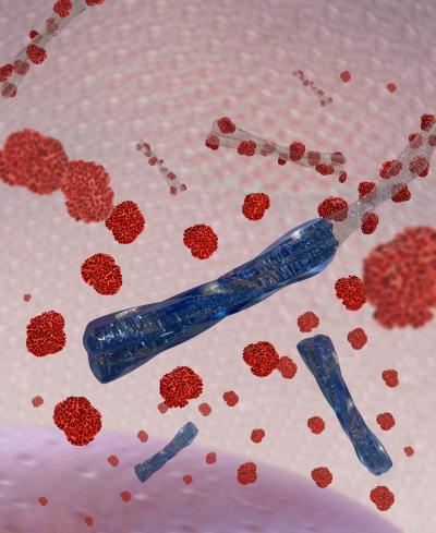 Coating for Amyloid