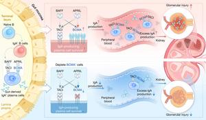 BCMA as a Key Driver in IgA Nephropathy