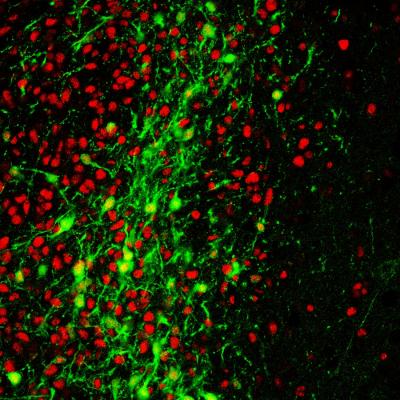 Differentiation of human iPSC-MGE cells (red) into neuropeptide Y positive interneurons (green) in the epileptic hippocampus.