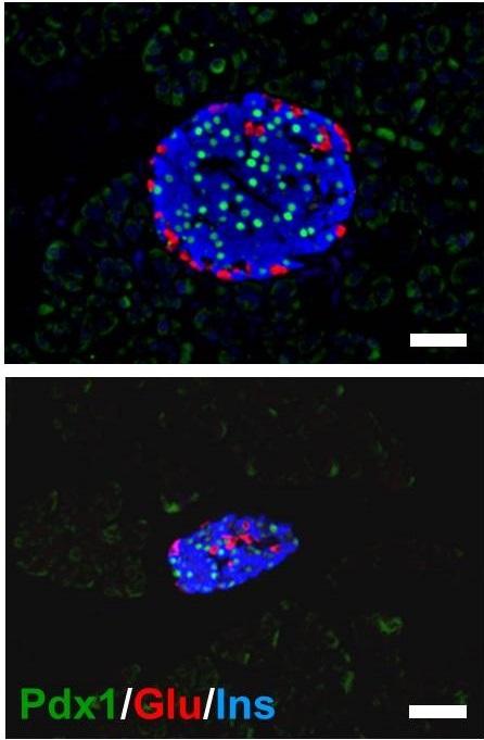 Cell Non-Autonomous Effects Disrupt the Spatial Organization of Endocrine Tissue