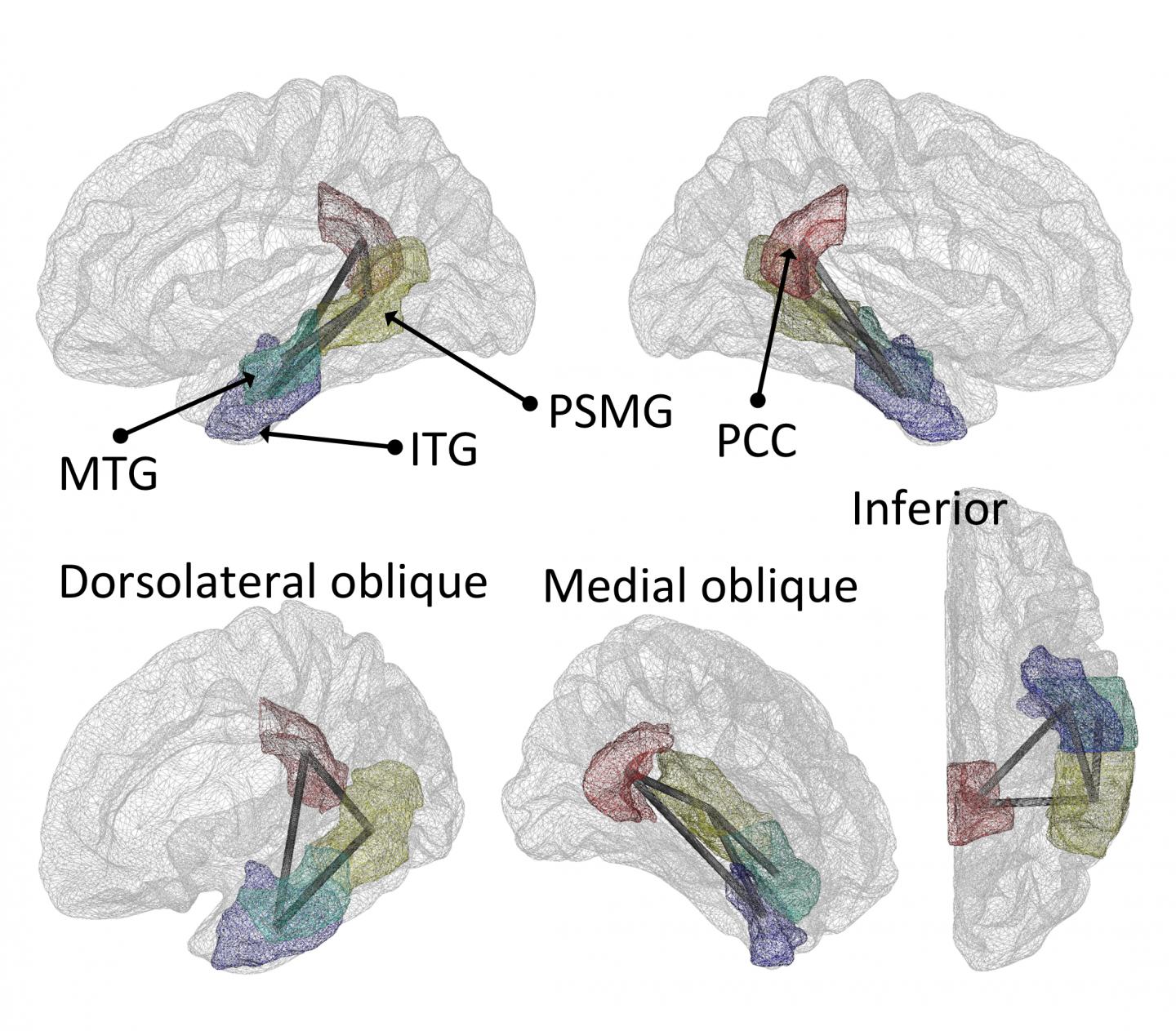 Cortical Brain Regions 