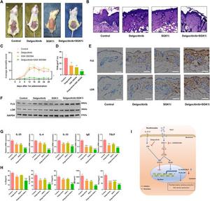 SGK-1 inhibitor relieves atopic dermatitis symptoms in vivo and exerts synergistic effects with JAK inhibitor.