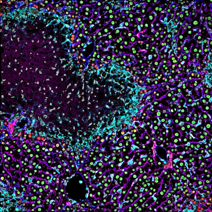 Multiplex immunofluorescence staining of liver tissue 48 hours after concanavalin A-induced liver injury.