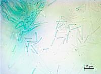 Cyanobacteria 2