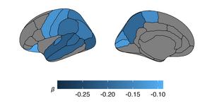 brain imaging cortical thickness