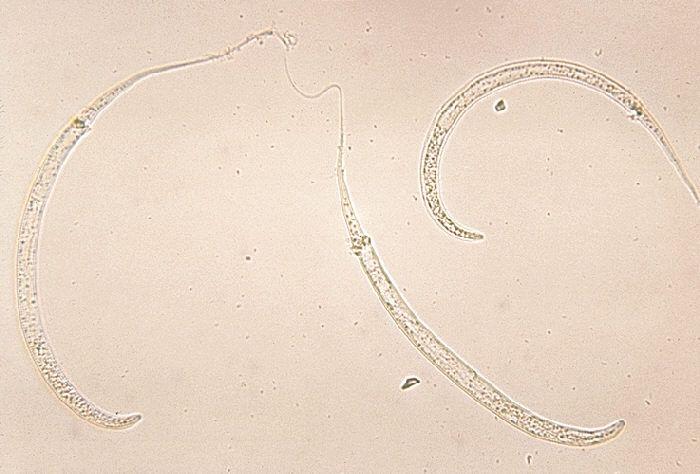 Researchers Analyze Cost-Effectiveness of Guinea Worm Disease Eradication