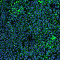 RPE cells derived from iPSCs