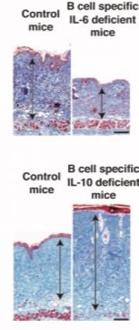 Skin Fibrosis