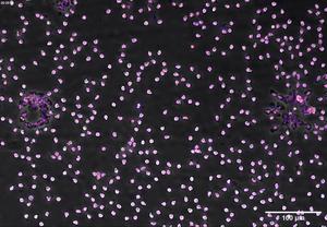 Immune cells swarm bacteria particles