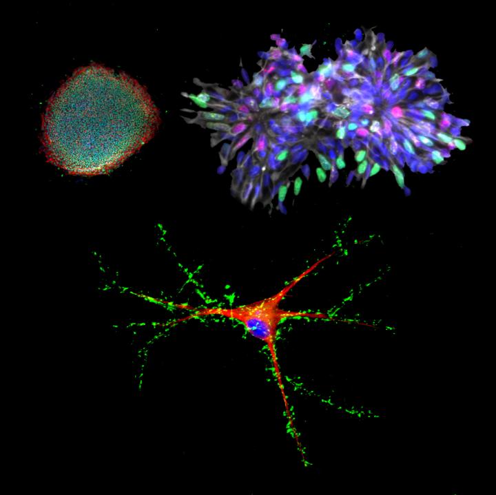 Using iPS Cells to Study Psychiatric Disorders