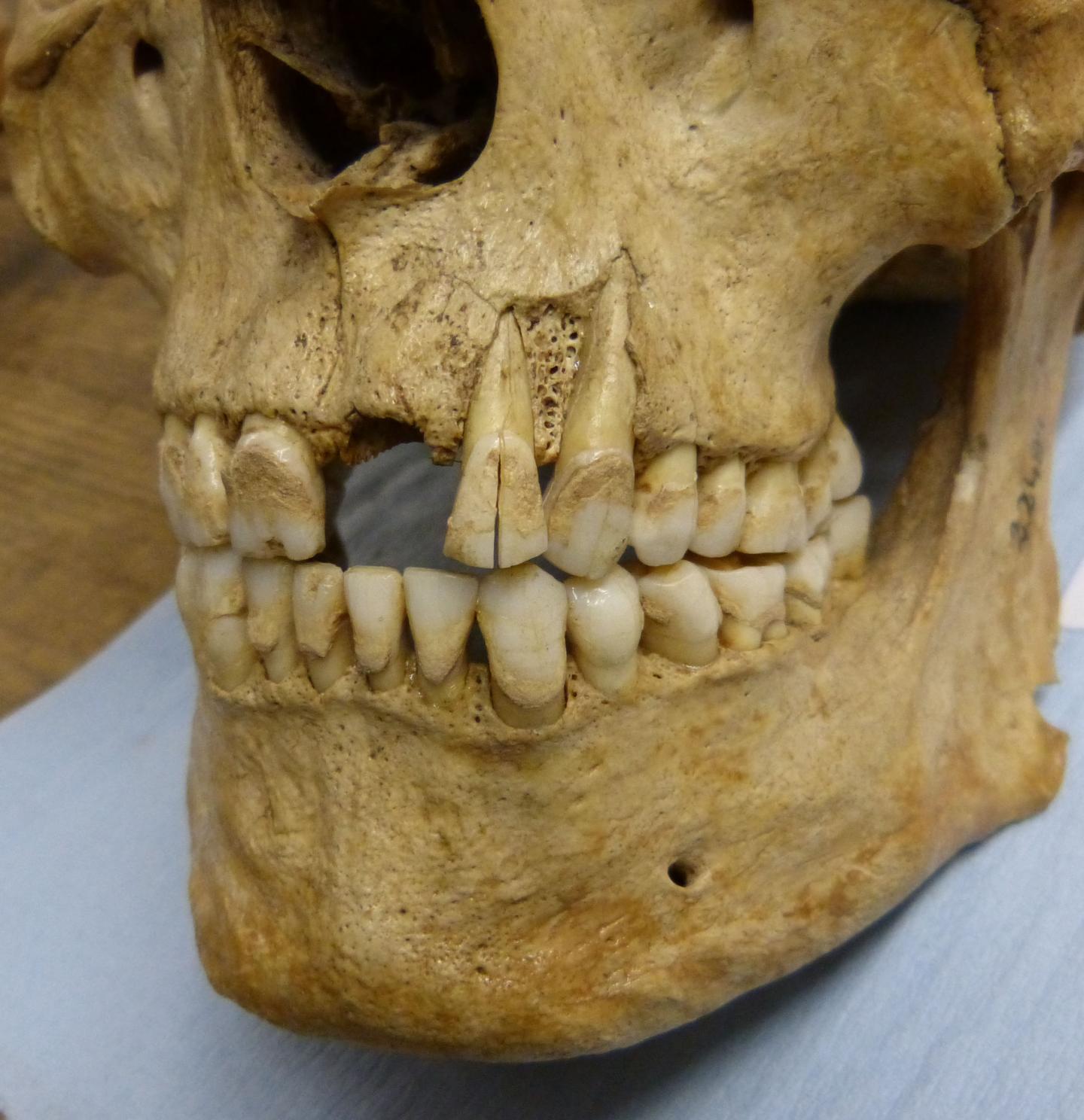 Skeleton Sampled for the Study