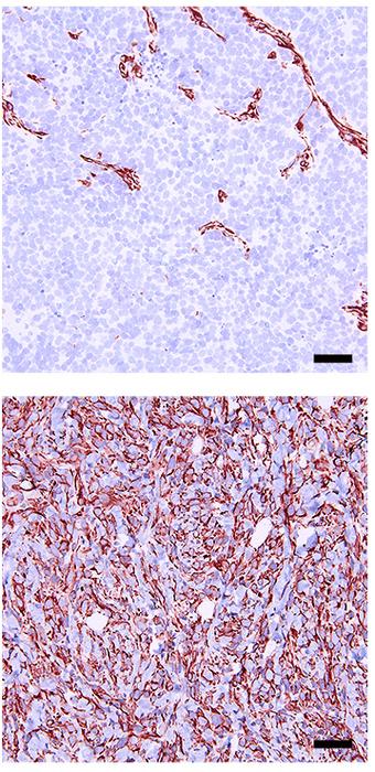 NEPC markers are lost upon Sirt1 silencing