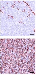 NEPC markers are lost upon Sirt1 silencing