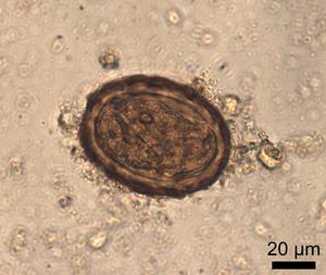 Roundworm egg