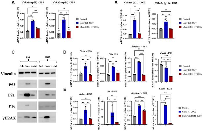 Spatially fractionated mini-GRID radiotherapy differentially modulates radiation-induced senescence in murine glioma and normal cells