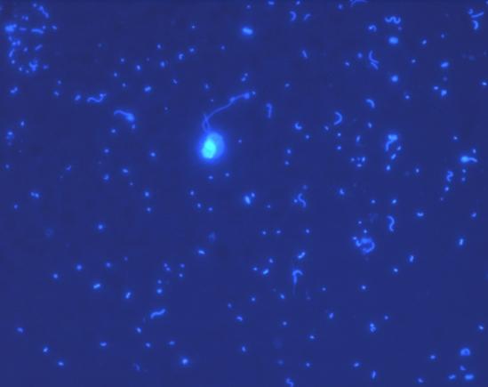 Bacterioplankton