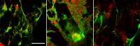 Neutrophil Extracellular Traps