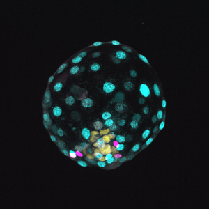 Human blastoid 2