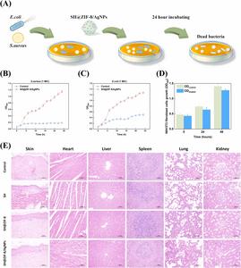 Enhanced healing of infected wounds following SH@ZIF-8/AgNPs treatment