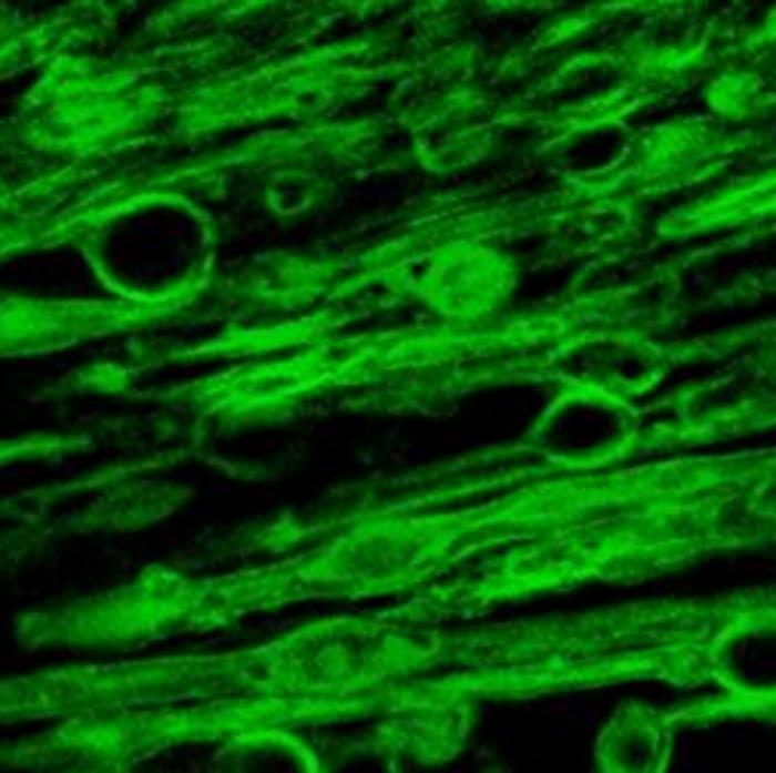 Myelin swellings as observed under the microscope
