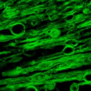 Myelin swellings as observed under the microscope